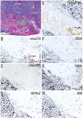 Human lymph node degeneration in the thoracic region: A morphometric and immunohistochemical analysis using surgically obtained specimens